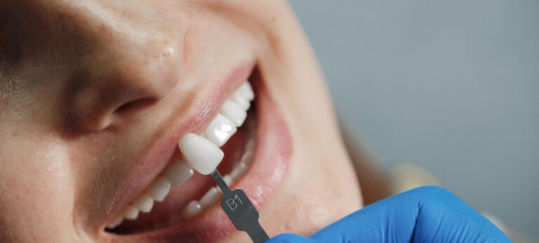 stomatologia estetyczna kraków