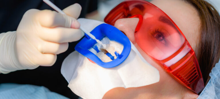 profesjonalne wybielanie zębów kraków